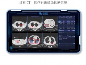 红桃 CT：医疗影像辅助诊断系统